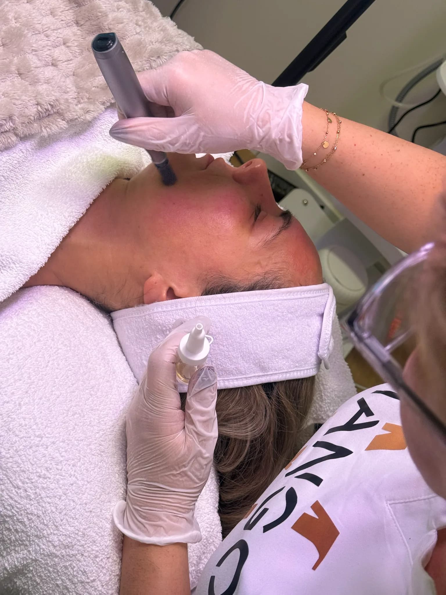 Bright Face – Microneedling mit Phi Serum — Sahel Beauty Frankfurt (Bild 2)