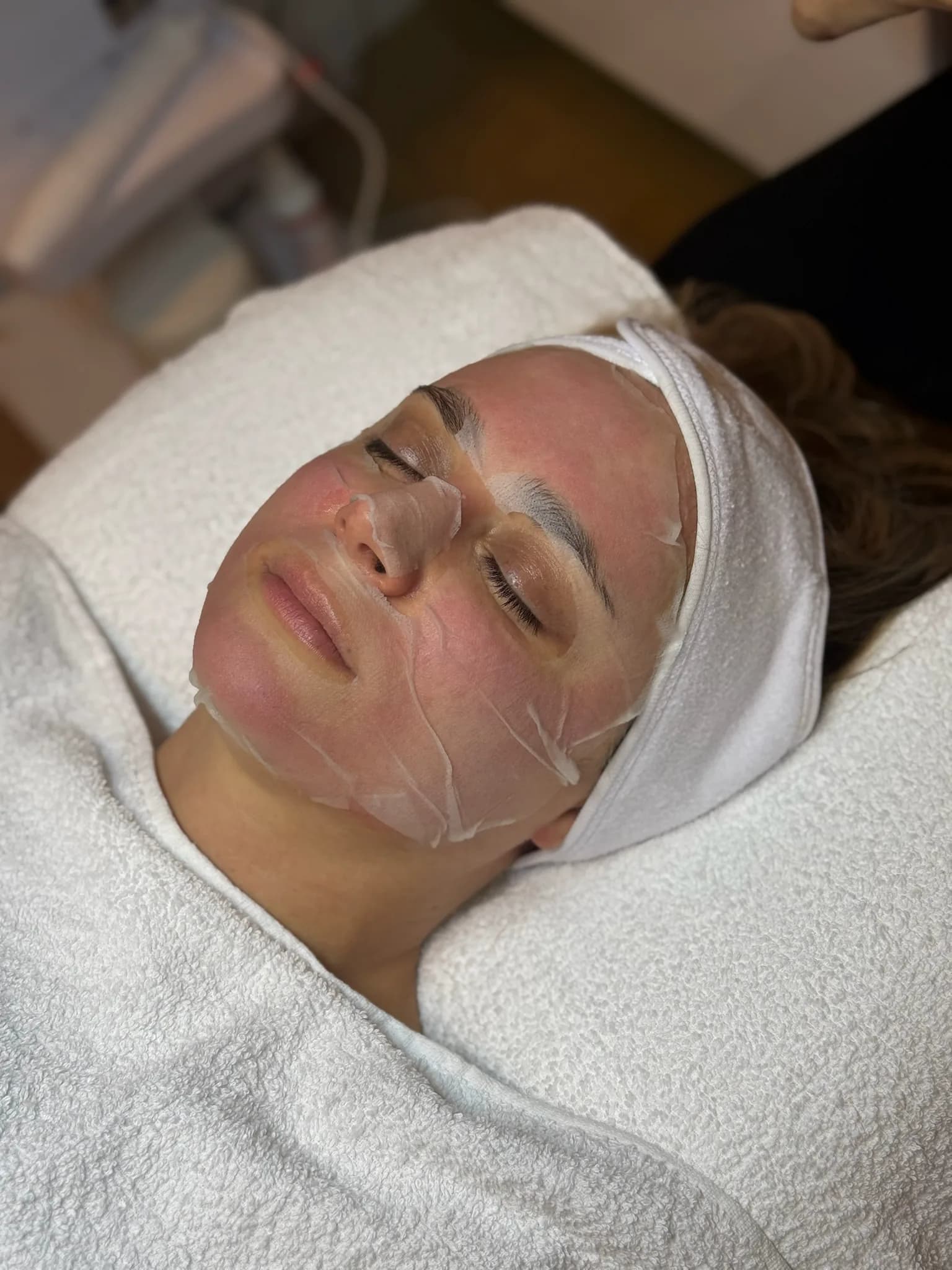 Bright Face – Microneedling mit Phi Serum — Sahel Beauty Frankfurt (Bild 5)