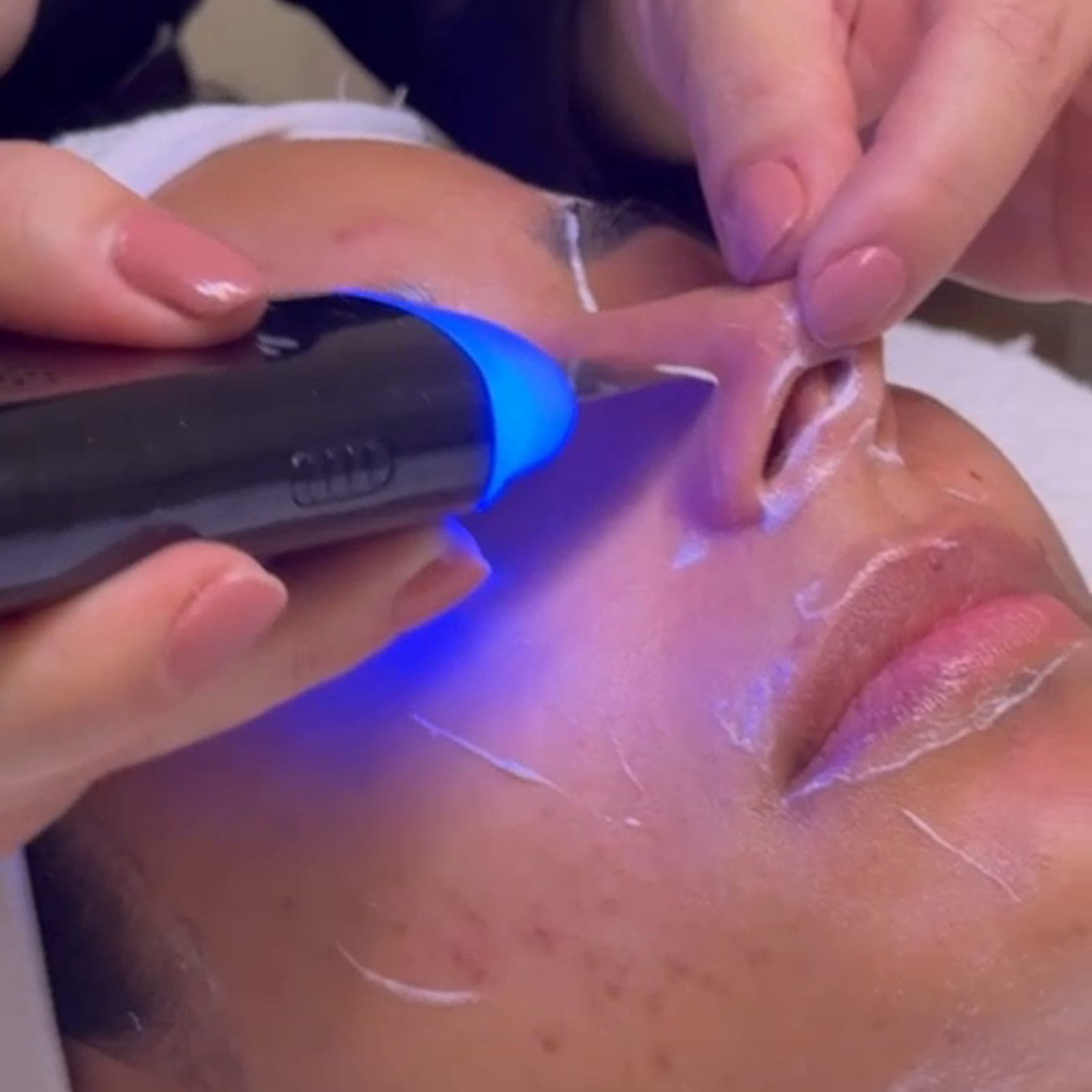 HydroBoost – Aquafacial — Sahel Beauty Frankfurt (Bild 9)