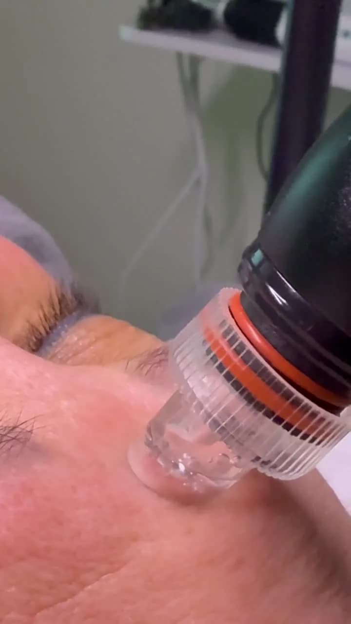 HydroBoost – Aquafacial — Sahel Beauty Frankfurt (Bild 12)