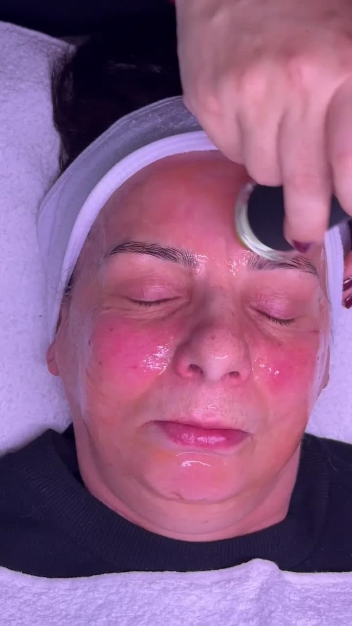 Pollogen Therapy – OxyGeneo — Sahel Beauty Frankfurt (Bild 2)