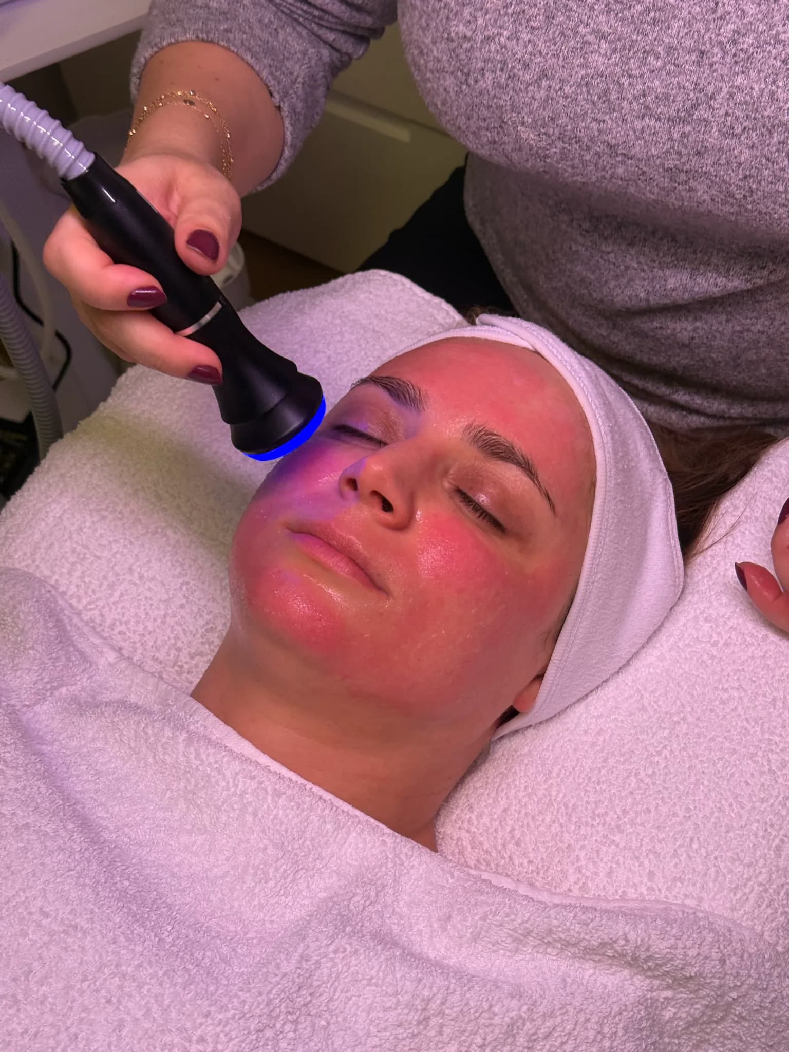 Radiofrequenz-Lifting Behandlung im Kosmetikstudio Sahel Beauty Frankfurt-Europaviertel — Sahel Beauty Frankfurt (Bild 3)